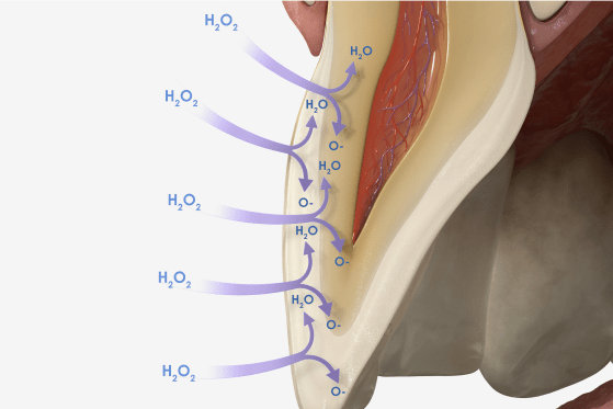 Afbeelding van voorbeeld bleekbehandeling
